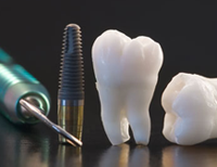 cropped2_dental_implant.png